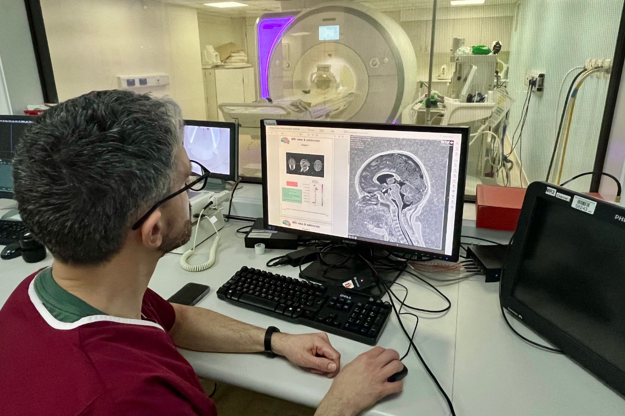 AI Bantu Deteksi Lesi Otak Epilepsi yang Sulit Ditemukan Dokter