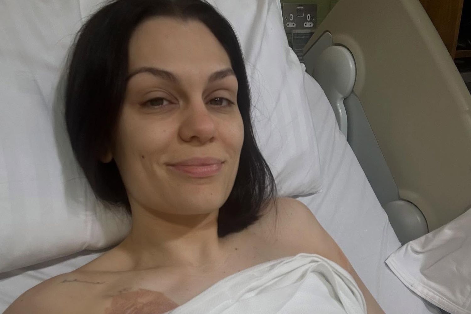 Jessie J Belum Sembuh dari Kanker Payudara, Rehat dari Medsos Usai Postingan Disalahpahami
