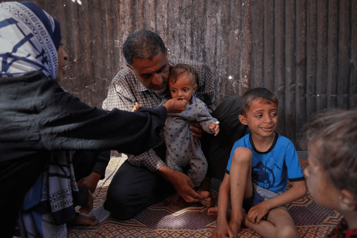 Kondisi Gaza Makin Mengerikan: Balita Alami Busung Lapar, Ibu Hamil Kehilangan Bayi, Dunia Diminta Bertindak