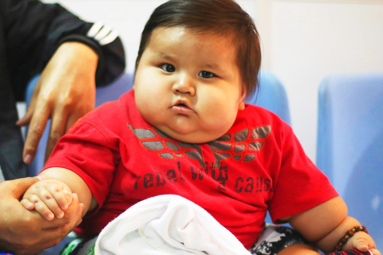 Obesitas Anak Indonesia Meningkat Drastis, Gara-Gara Makanan Instan dan Iklan di Medsos?