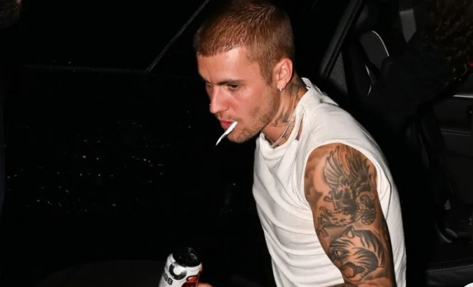 Justin Bieber Cedera Jelang Coachella! Kondisinya Bikin Kaget, tapi Tetap Nekat Latihan