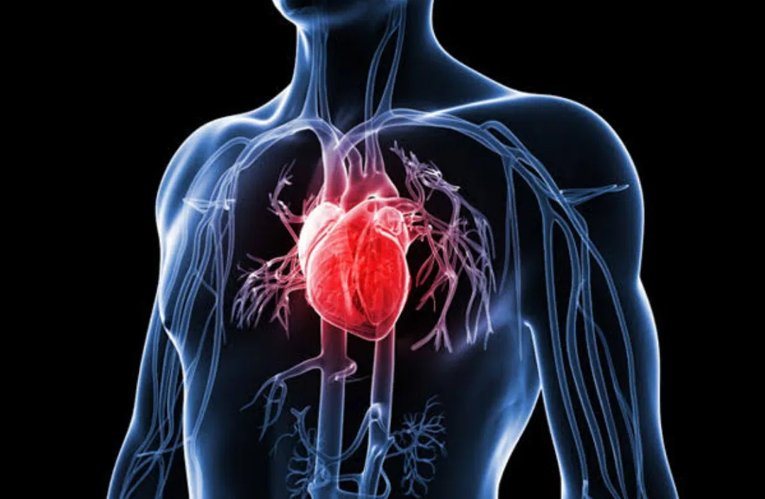 Mengenal Fibrilasi Atrium, Gangguan Irama Jantung yang Meningkatkan Risiko Stroke