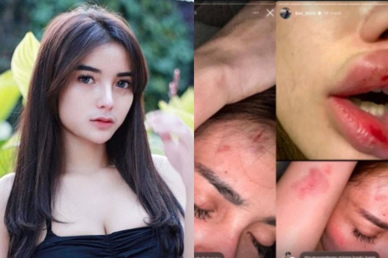 Sosok Nabilla Aprillya, Mantan Pacar Atta Halilintar yang Terseret Isu KDRT dengan Ketum Parpol Berpengaruh