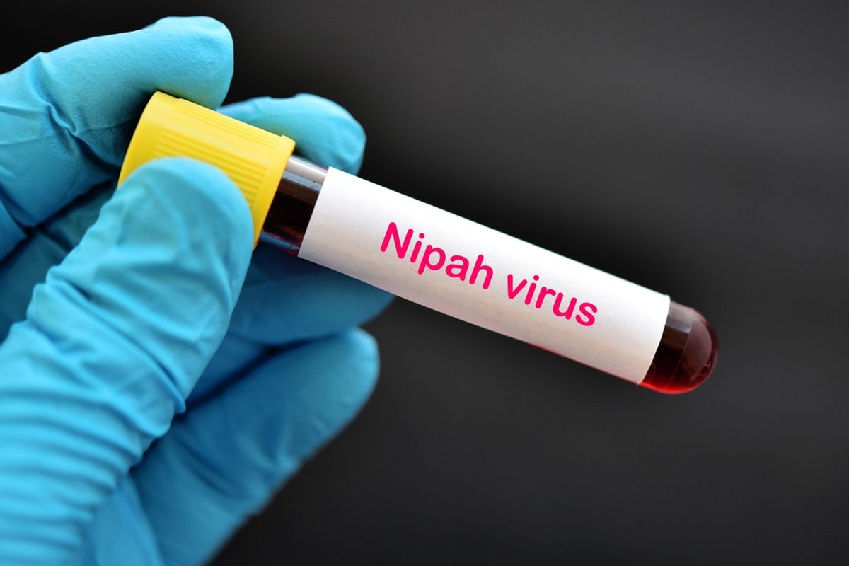Waspada! Ancaman Virus Nipah Kian Dekat, Ini Langkah Pencegahan dari Kemenkes