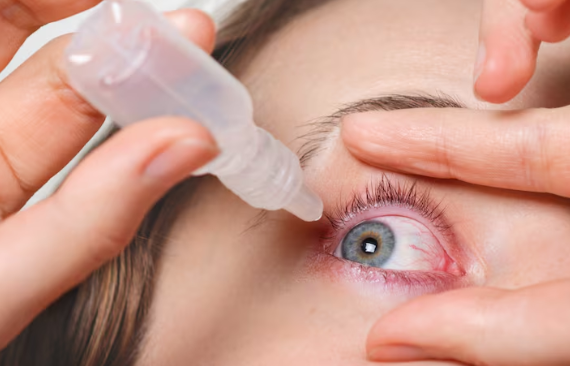 Gejala Herpes Mata Yang Sering Dianggap Sepele, Waspadai Tanda Infeksi Virus Ini Sebelum Merusak Penglihatan Kamu Secara Permanen