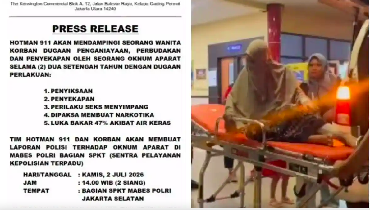 Hotman Paris Bongkar Dugaan Kekejaman Oknum Aparat, Korban Disebut Disekap 2,5 Tahun hingga Disiram Air Keras
