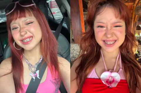 Apa Itu Tooth Gems? Tren Kecantikan Y2K yang Dipopulerkan Naykilla