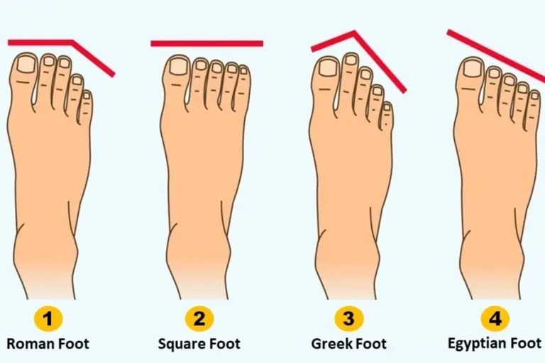 Mengenal 4 Tipe Kepribadian dari Bentuk Kaki dan Sifat Rahasia di Baliknya: Dari Roman Foot Hingga Egyptian Foot