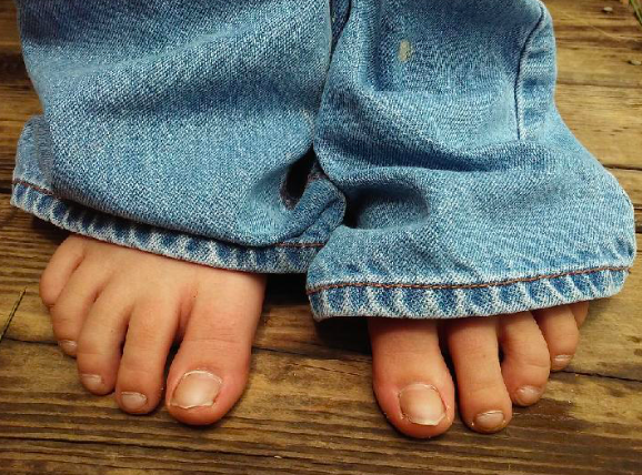 Jangan Disepelekan! 5 Perubahan pada Kuku Ini Bisa Jadi Sinyal Masalah Kesehatan