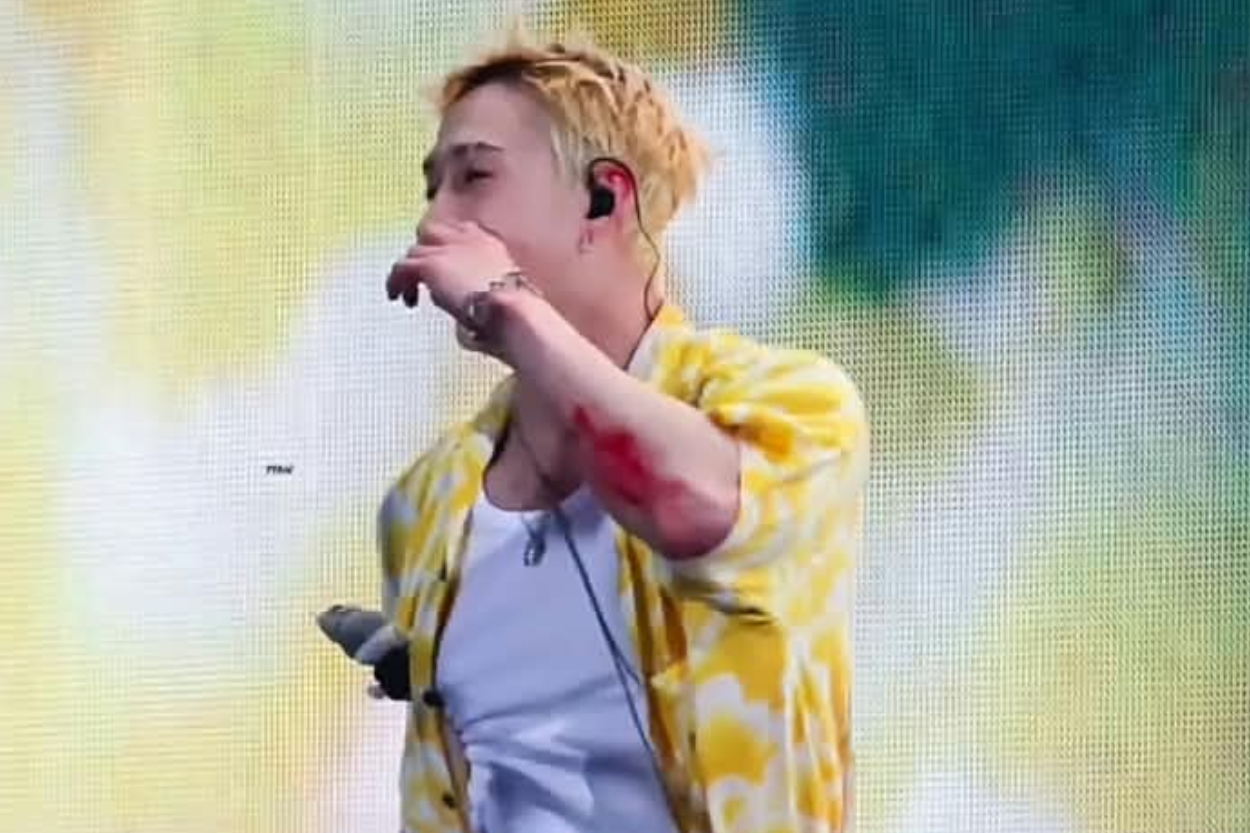 Terpeleset Berulang Kali Saat Konser di Tokyo, Begini Kondisi Kesehatan Member Stray Kids: Lengan Bang Chan Berdarah hingga Lee Know Dilarikan ke Rumah Sakit