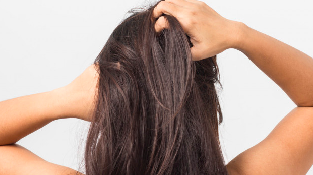 Sudah Rajin Keramas, Kok Rambut Tetap Lepek? Ini yang Mungkin Terjadi di Kulit Kepala
