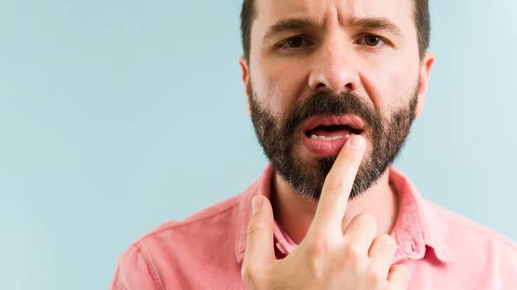 5 Rekomendasi Lip Balm Pria untuk Merawat Bibir Gelap dan Kering