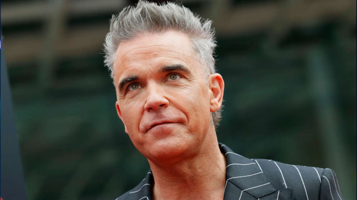 Musisi Robbie Williams Tunjukkan Gigi Baru yang Membuatnya Terlihat Lebih Muda